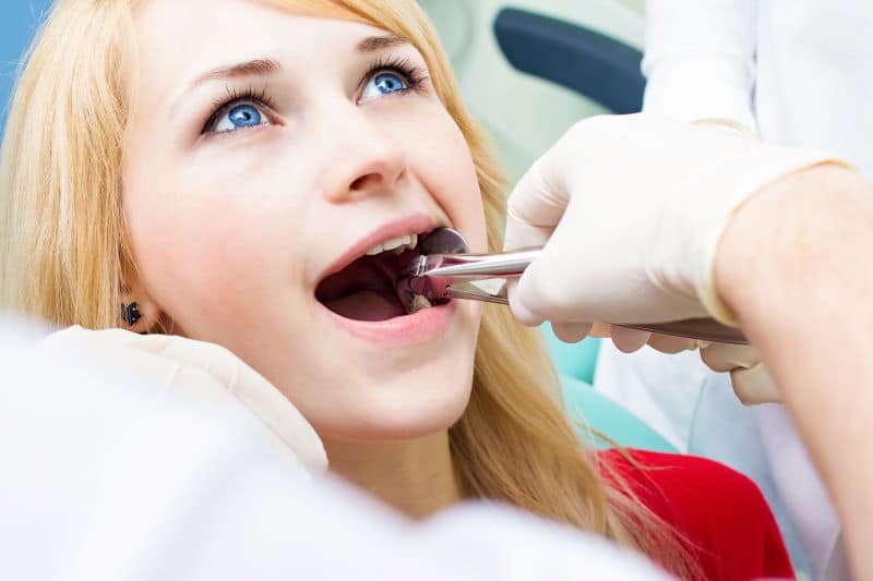 wisdom teeth